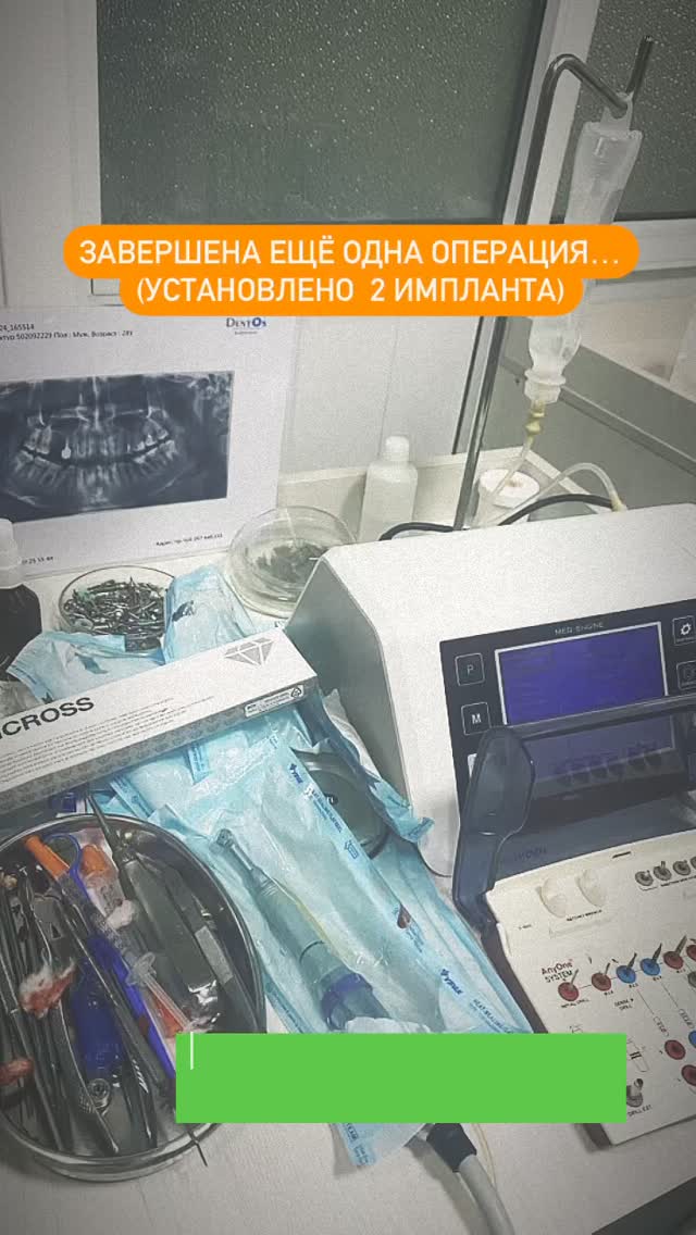 Имплантация