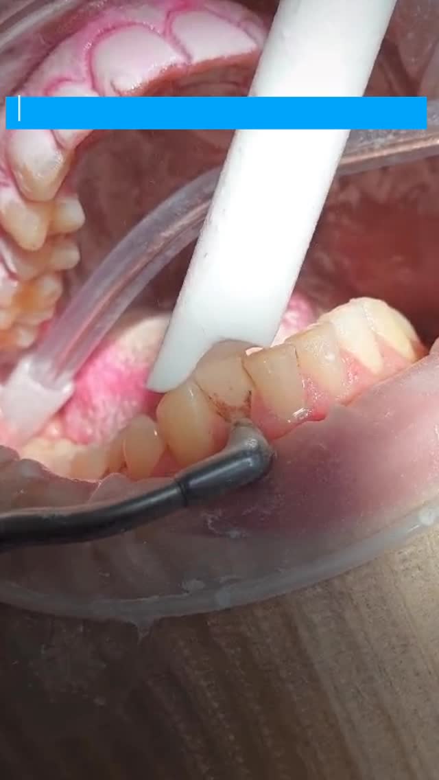 Профчистка