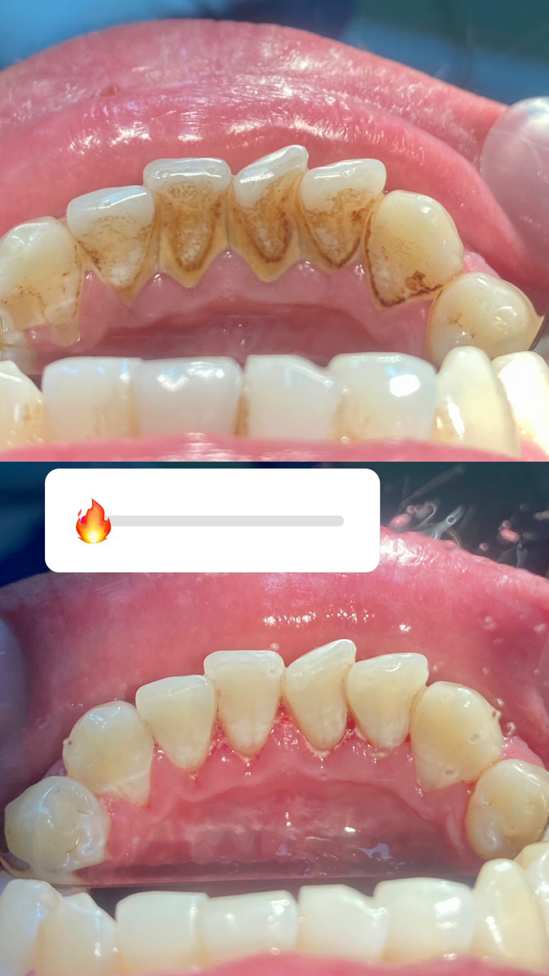 Проф.Чистка