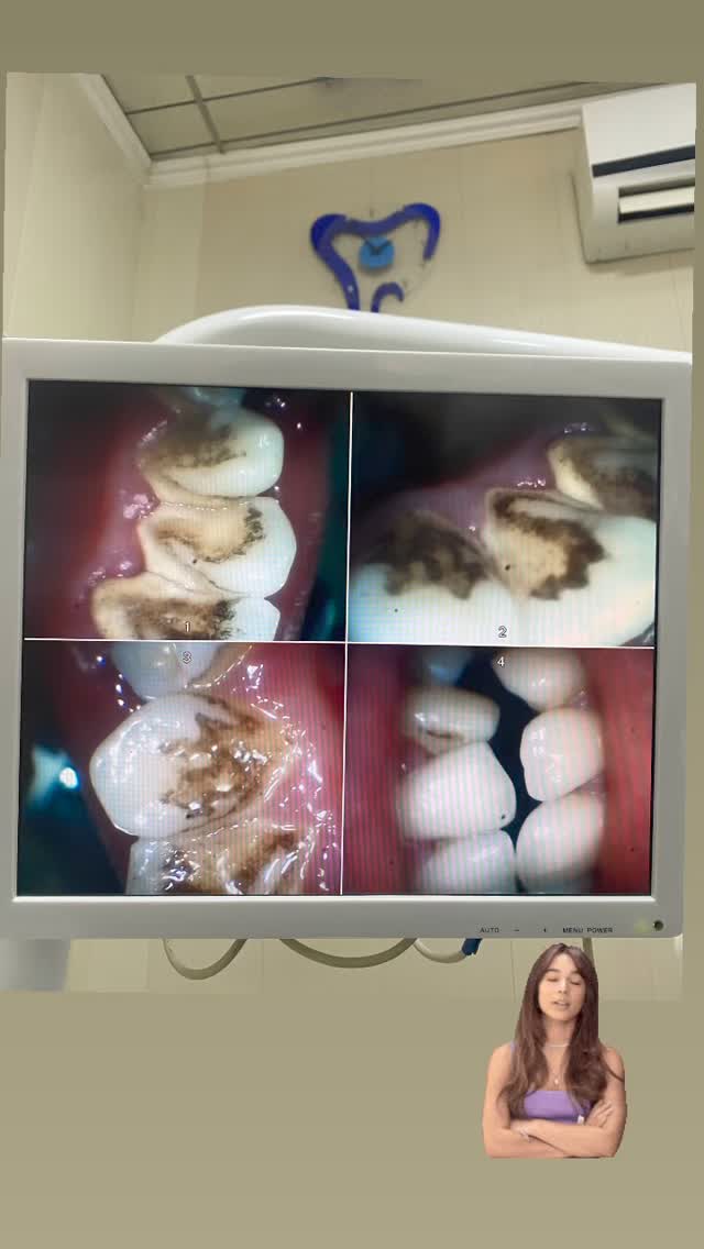 Профчистка