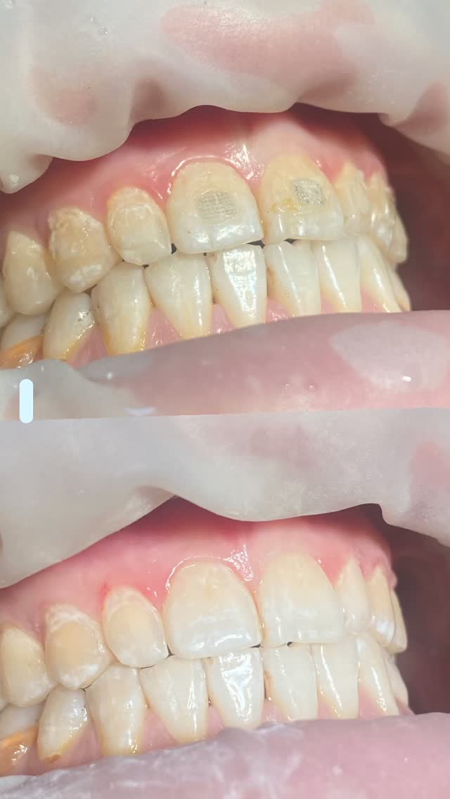 Проф.Чистка