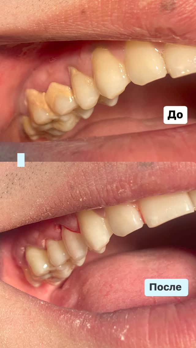 Проф.Чистка