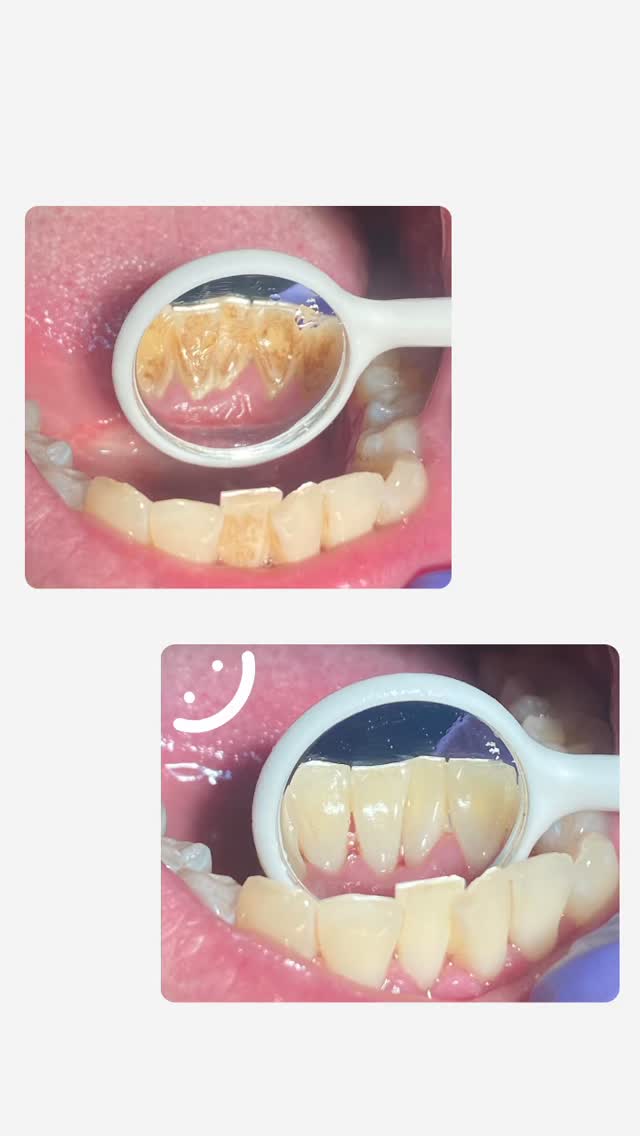 Проф.Чистка