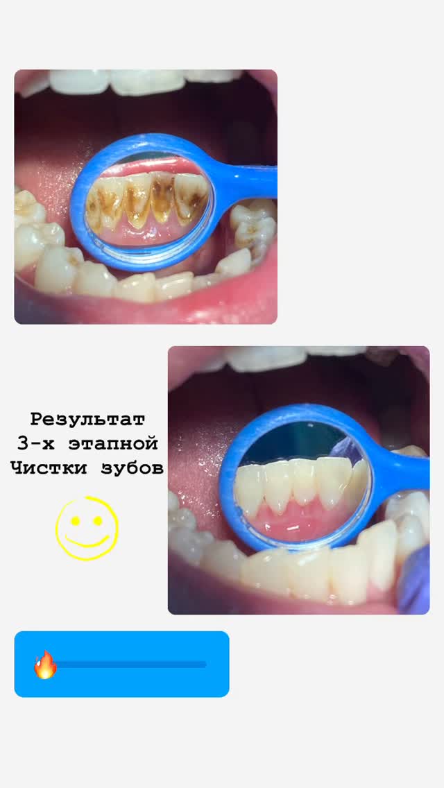 Проф.Чистка