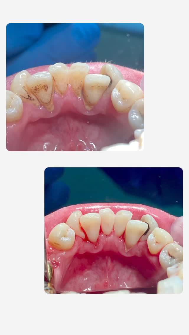 Проф.Чистка