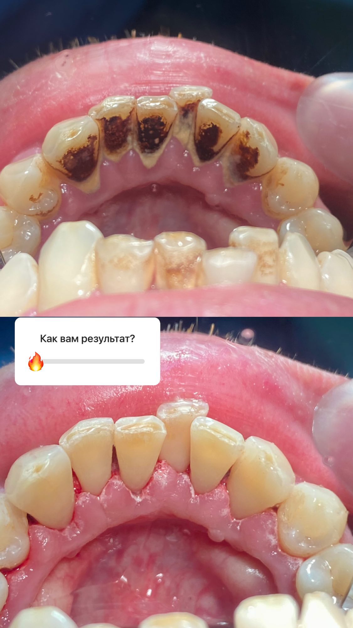 Проф.Чистка