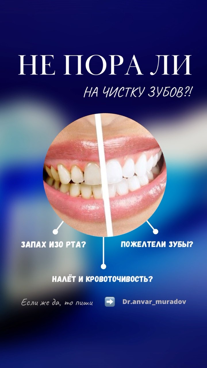 Профессиональная чистка